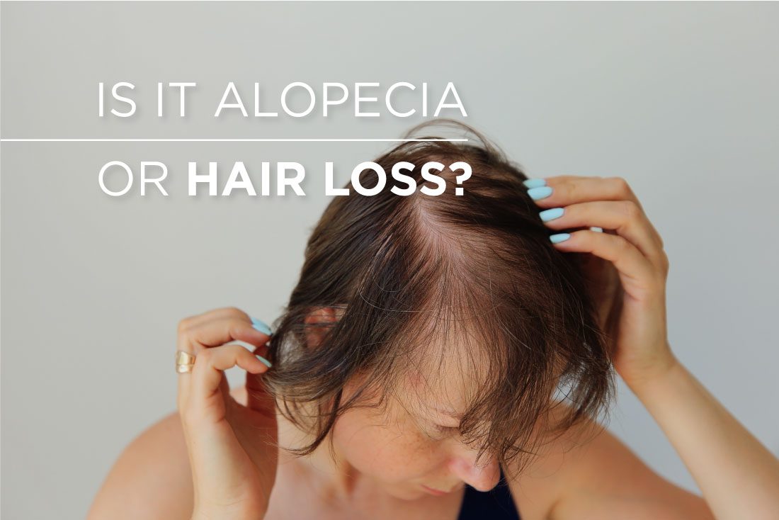 alopecia or hair loss
