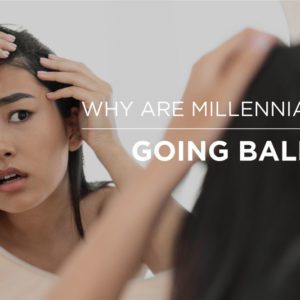 millennials going bald hair loss